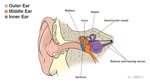 Hole in the Eardrum & Myringoplasty