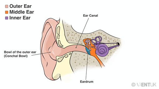 Self-help tips: itchy ears and earwax build-up