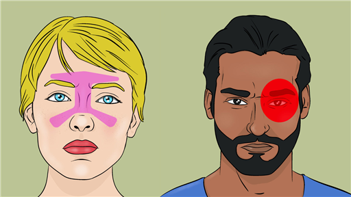 Facial Pain