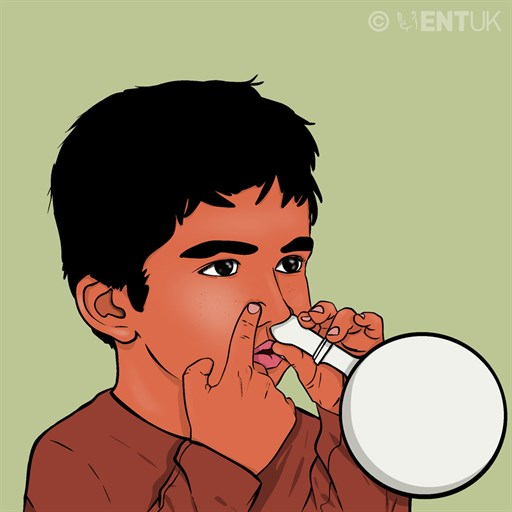 Glue Ear - Otitis Media with Effusion (OME)