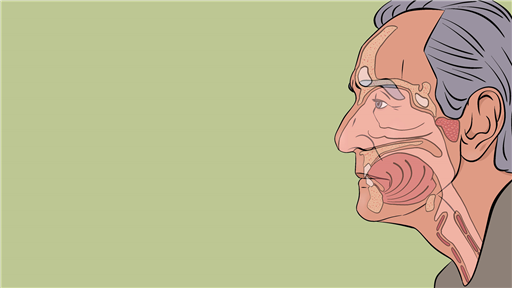 Head and Neck Cancer