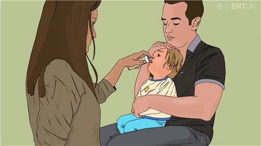 Chronic rhinosinusitis in children