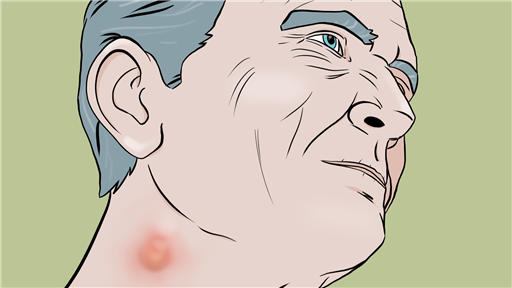 Neck lump clinic