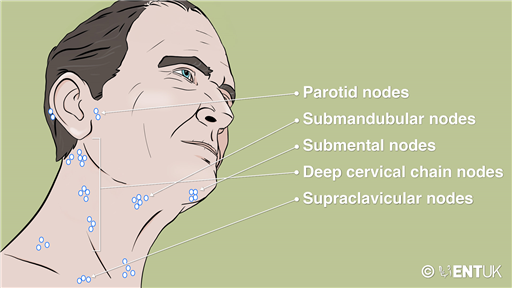 Neck Dissection