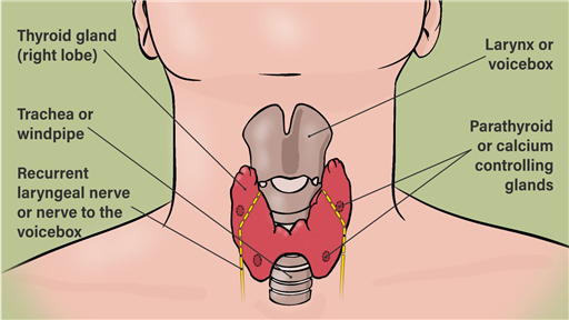 Thyroid lumps and thyroid surgery - Diagnostic hemithyroidectomy