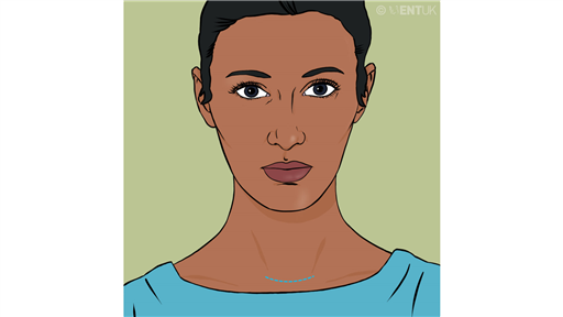 Thyrotoxicosis - Thyroid surgery for benign thyroid disease