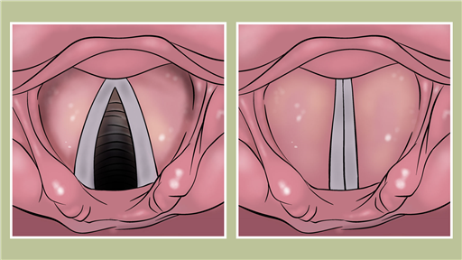 Your voice and how to look after it